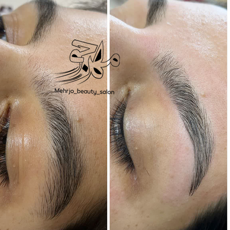 اصلاح با بند در مسکن یزد